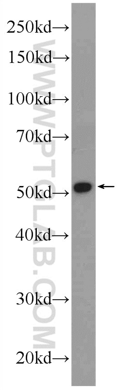 WB analysis of L02 using 16101-1-AP