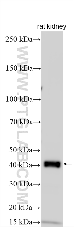 Western Blot (WB) analysis of various lysates using CGRRF1 Polyclonal antibody (16101-1-AP)