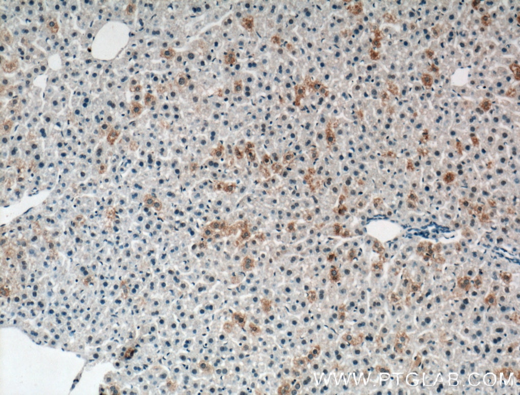 IHC staining of mouse liver using 16734-1-AP