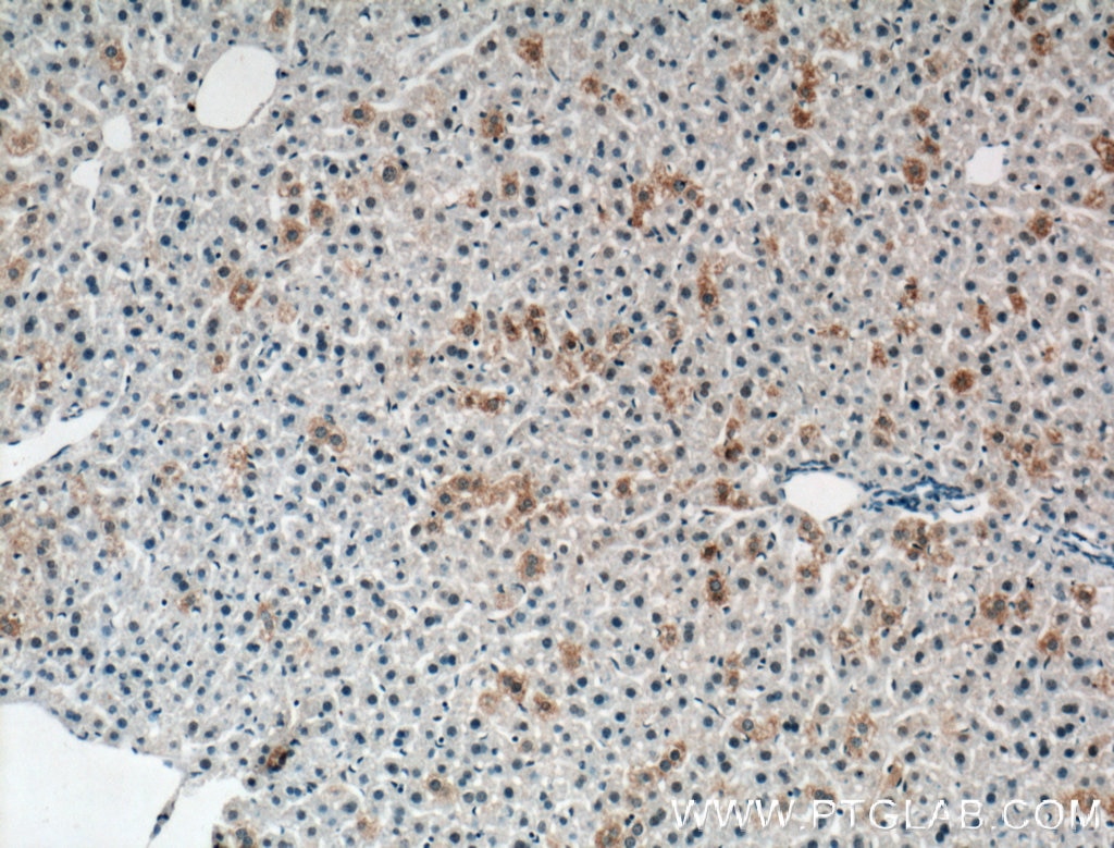 Immunohistochemistry (IHC) staining of mouse liver tissue using CH25H Polyclonal antibody (16734-1-AP)