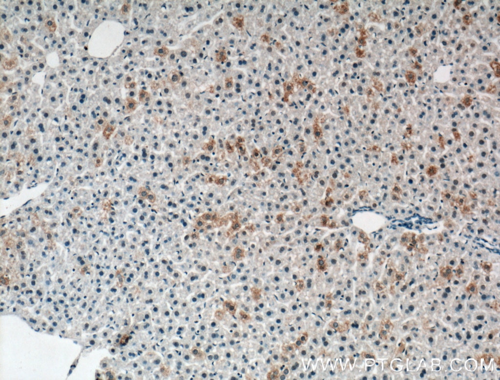 Immunohistochemistry (IHC) staining of mouse liver tissue using CH25H Polyclonal antibody (16734-1-AP)