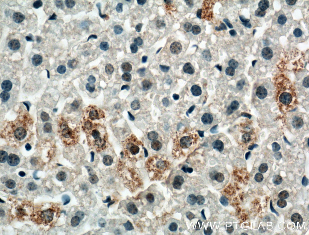 Immunohistochemistry (IHC) staining of mouse liver tissue using CH25H Polyclonal antibody (16734-1-AP)