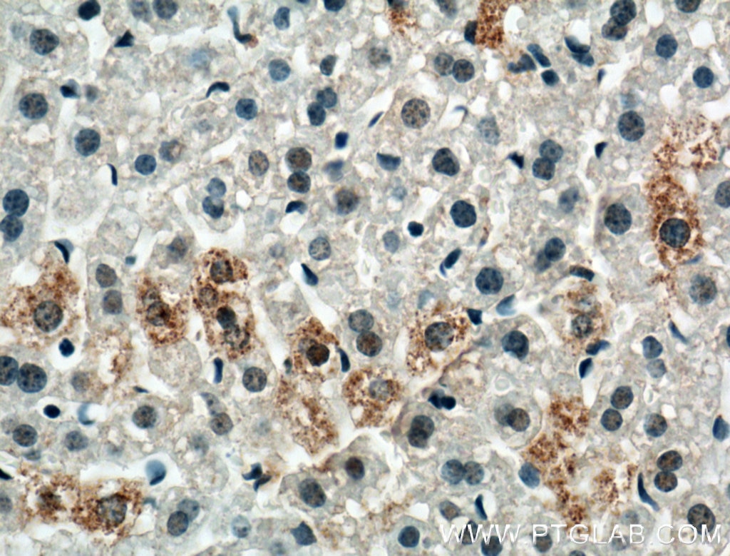 IHC staining of mouse liver using 16734-1-AP