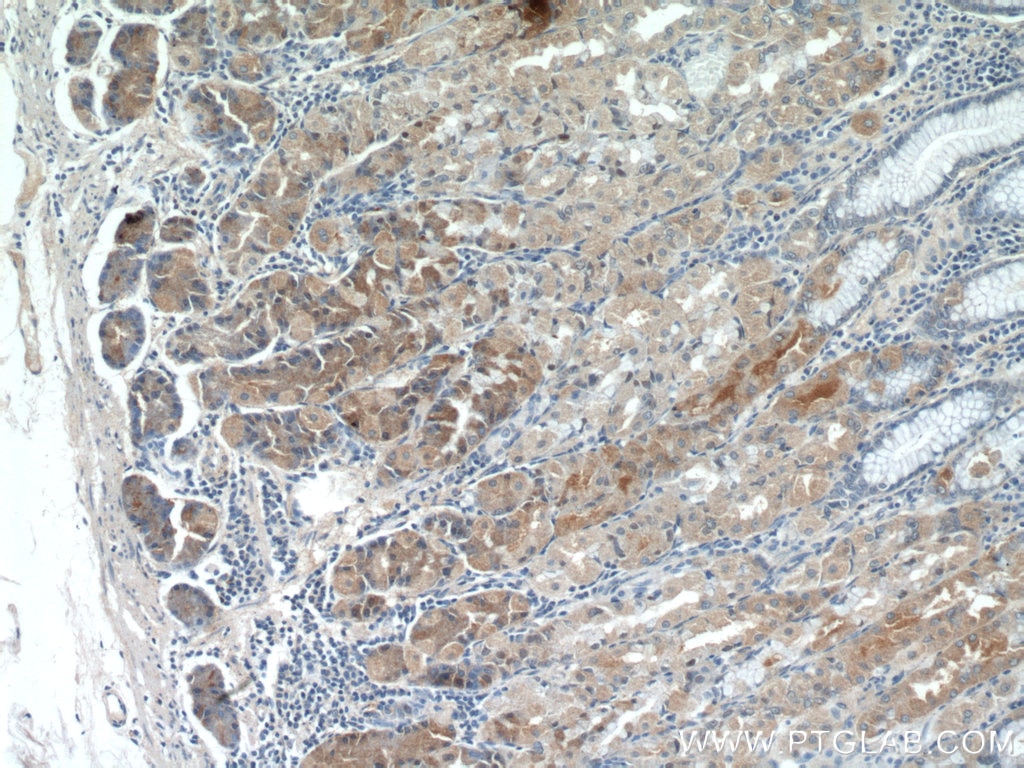 Immunohistochemistry (IHC) staining of human stomach tissue using CHAC1 Polyclonal antibody (15207-1-AP)