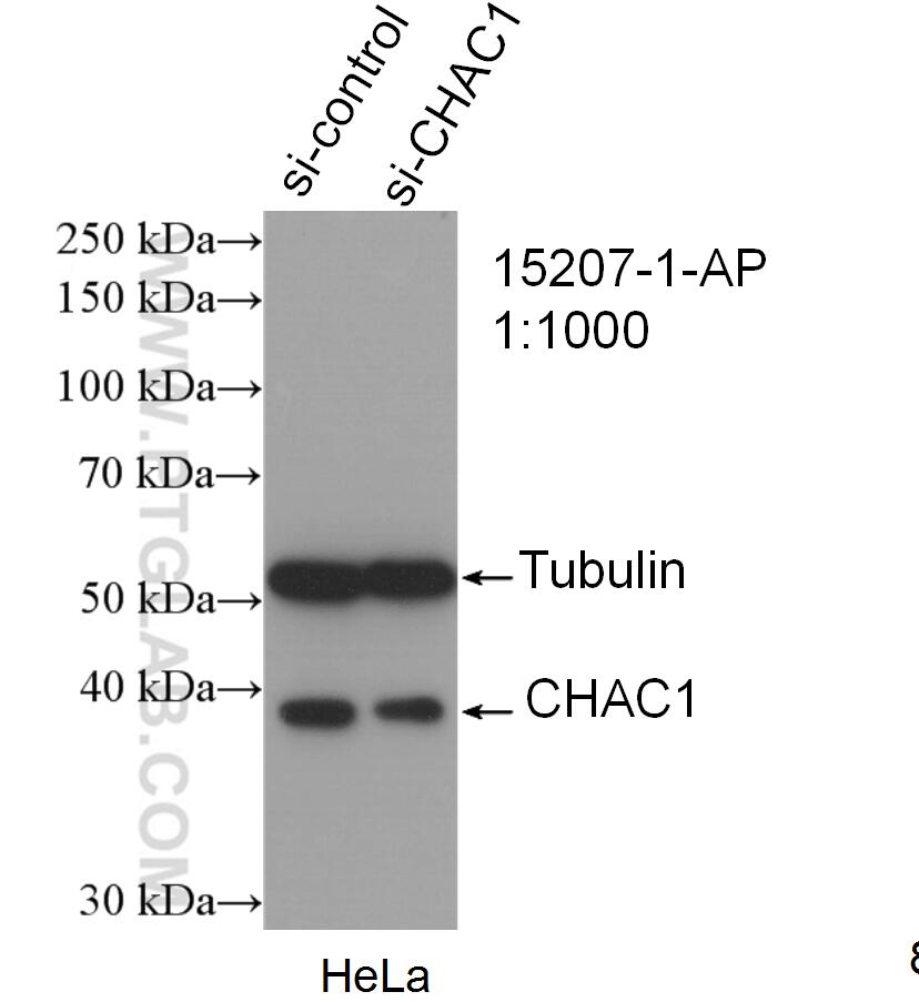 Western Blot (WB) analysis of HeLa cells using CHAC1 Polyclonal antibody (15207-1-AP)