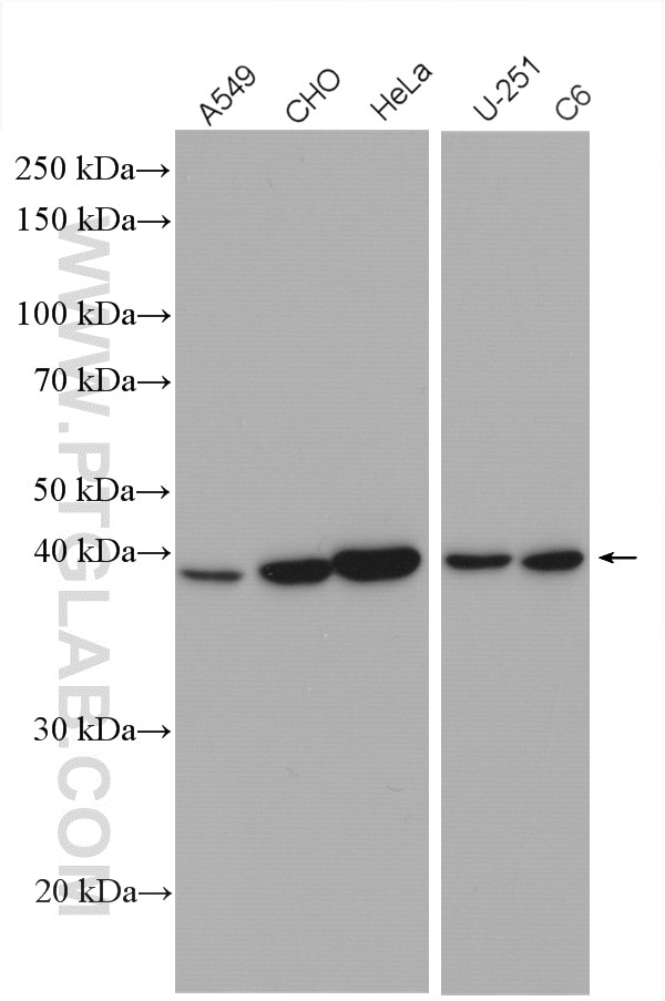 Western Blot (WB) analysis of various lysates using CHAC1 Polyclonal antibody (15207-1-AP)