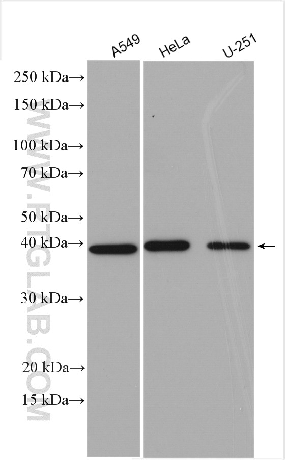 Western Blot (WB) analysis of various lysates using CHAC1 Polyclonal antibody (15207-1-AP)