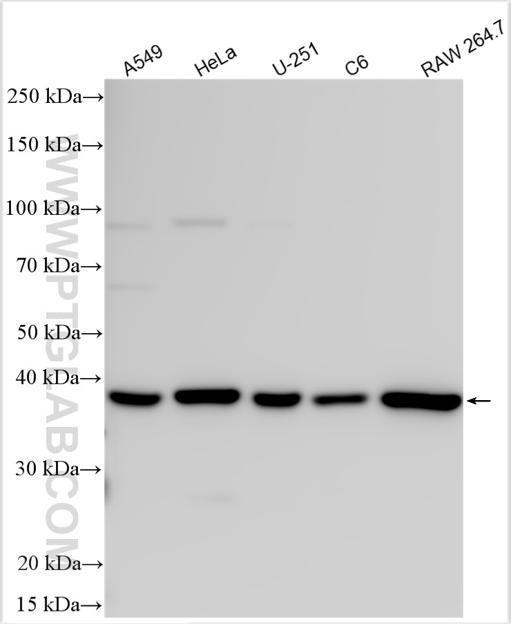 Western Blot (WB) analysis of various lysates using CHAC1 Polyclonal antibody (15207-1-AP)