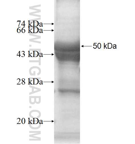 CHAC1 fusion protein Ag7360 SDS-PAGE