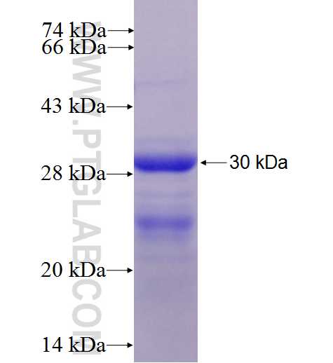CHAC1 fusion protein Ag7527 SDS-PAGE