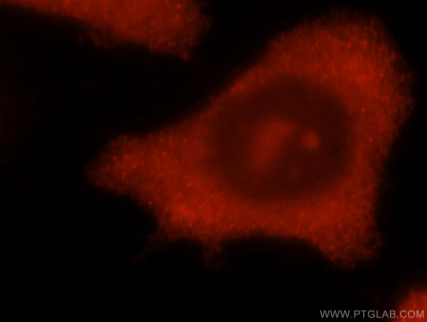 Immunofluorescence (IF) / fluorescent staining of MCF-7 cells using CHAC2 Polyclonal antibody (16304-1-AP)