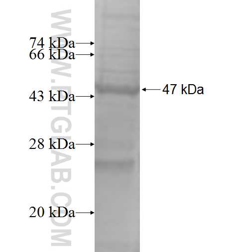 CHAC2 fusion protein Ag9281 SDS-PAGE
