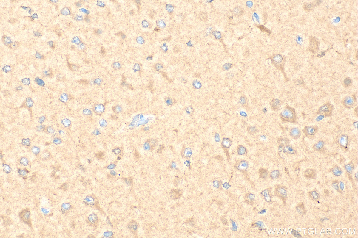 Immunohistochemistry (IHC) staining of mouse brain tissue using CHAD Polyclonal antibody (12963-1-AP)