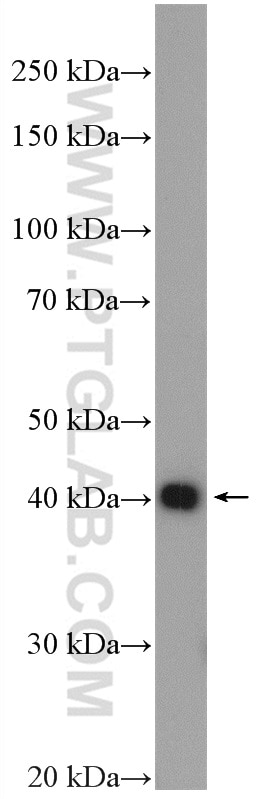 Western Blot (WB) analysis of HeLa cells using CHAD Polyclonal antibody (12963-1-AP)