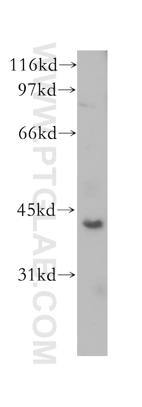 Western Blot (WB) analysis of MCF-7 cells using CHAD Polyclonal antibody (12963-1-AP)