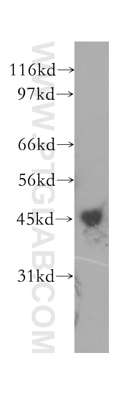 Western Blot (WB) analysis of Jurkat cells using CHAD Polyclonal antibody (12963-1-AP)