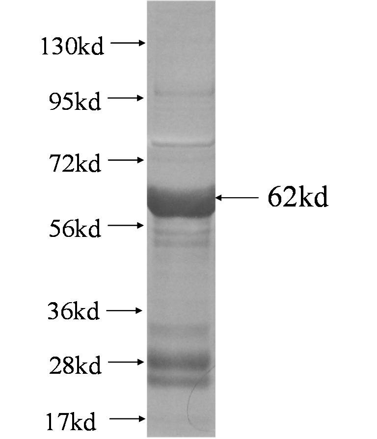 CHAD fusion protein Ag4077 SDS-PAGE