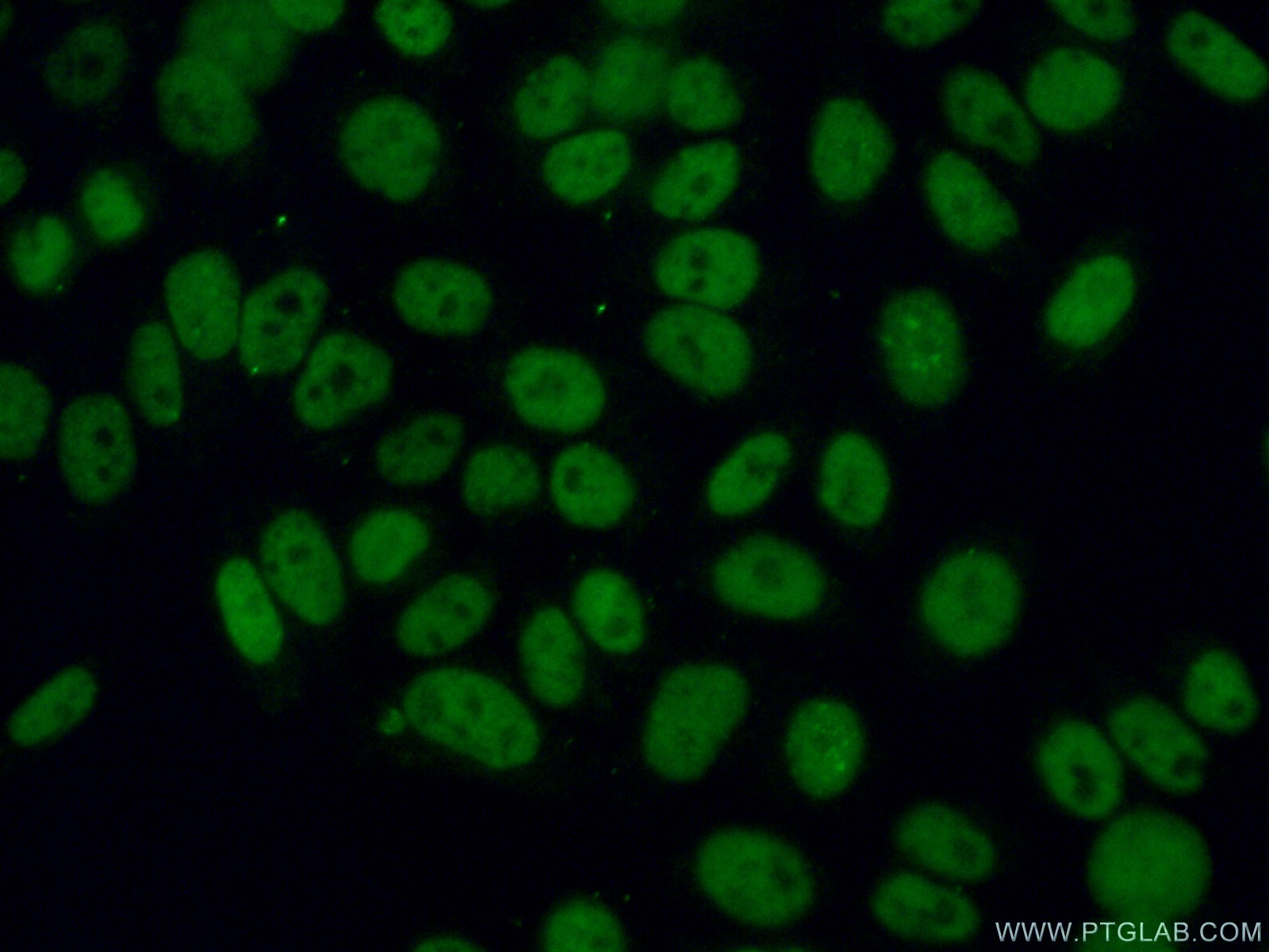 Immunofluorescence (IF) / fluorescent staining of HeLa cells using CHAF1A Polyclonal antibody (17037-1-AP)