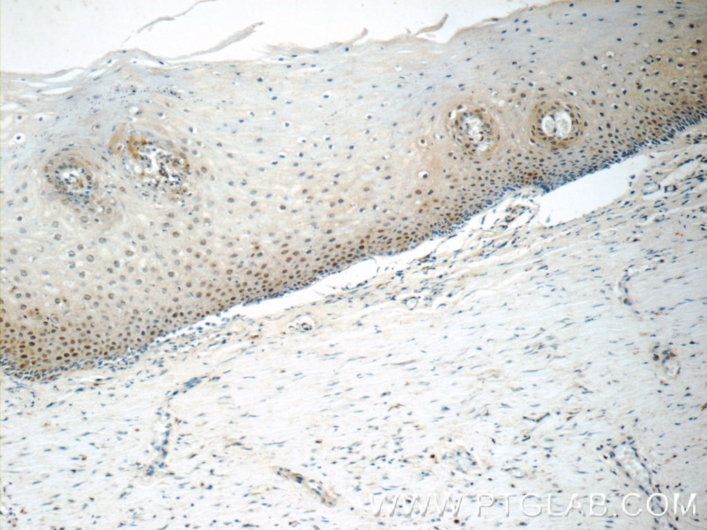 Immunohistochemistry (IHC) staining of human cervix tissue using CHAF1A Polyclonal antibody (17037-1-AP)