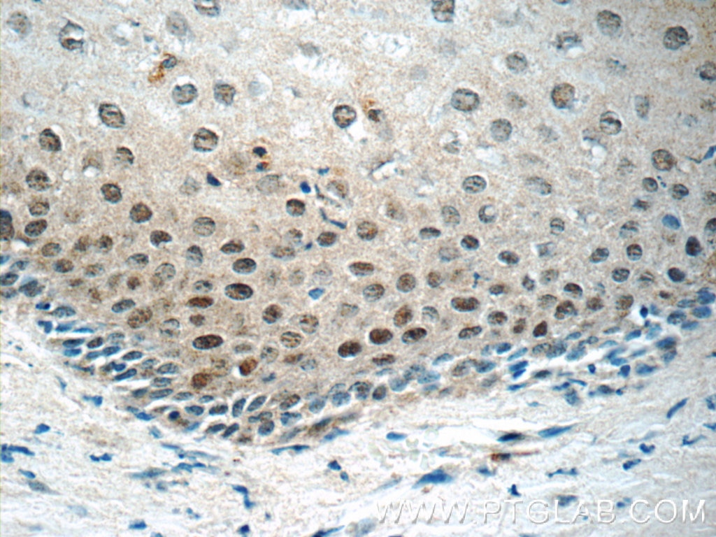 Immunohistochemistry (IHC) staining of human cervix tissue using CHAF1A Polyclonal antibody (17037-1-AP)