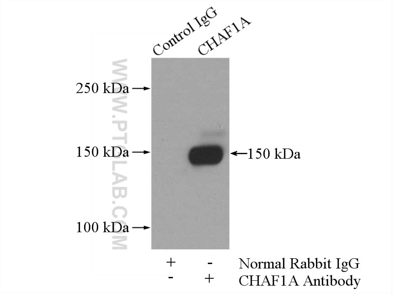 Immunoprecipitation (IP) experiment of Jurkat cells using CHAF1A Polyclonal antibody (17037-1-AP)