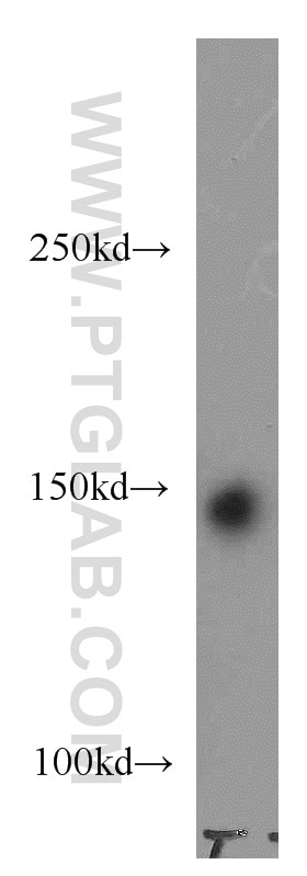 Western Blot (WB) analysis of HeLa cells using CHAF1A Polyclonal antibody (17037-1-AP)