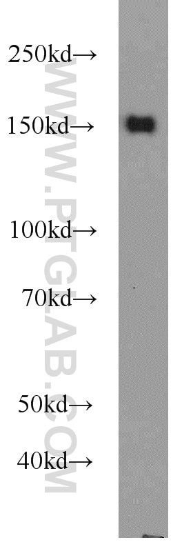 CHAF1A Polyclonal antibody