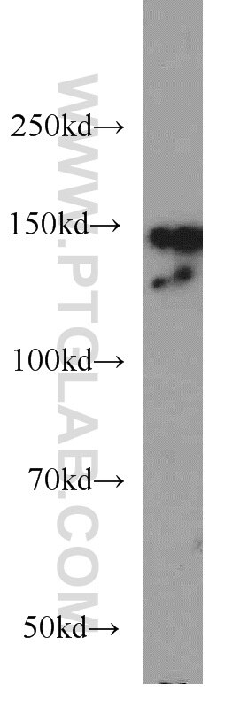 Western Blot (WB) analysis of HeLa cells using CHAF1A Polyclonal antibody (17037-1-AP)