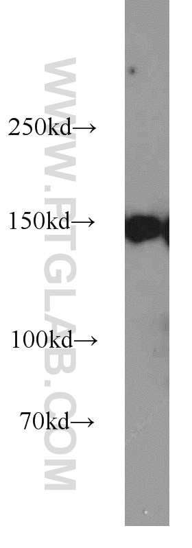 CHAF1A Polyclonal antibody