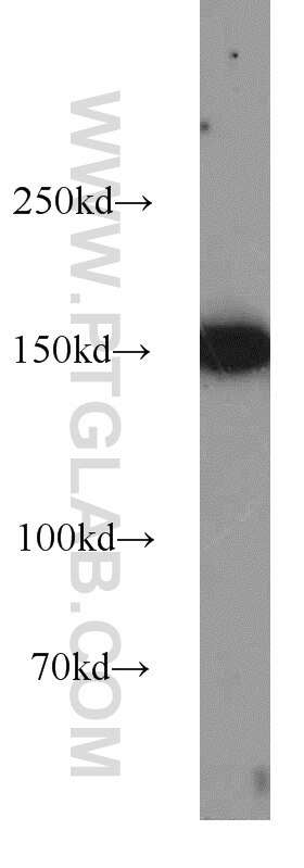 Western Blot (WB) analysis of Jurkat cells using CHAF1A Polyclonal antibody (17037-1-AP)