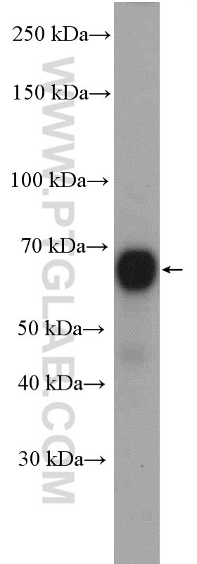 Western Blot (WB) analysis of HeLa cells using CHAF1B Polyclonal antibody (27633-1-AP)