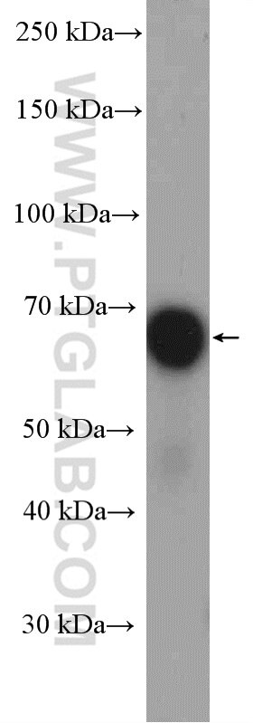 Western Blot (WB) analysis of HepG2 cells using CHAF1B Polyclonal antibody (27633-1-AP)