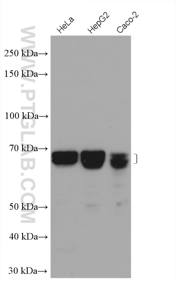 Western Blot (WB) analysis of various lysates using CHAF1B Polyclonal antibody (27633-1-AP)