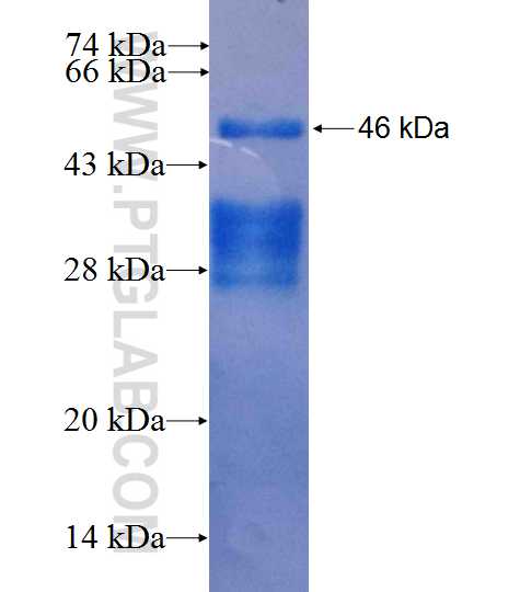 CHAF1B fusion protein Ag26504 SDS-PAGE