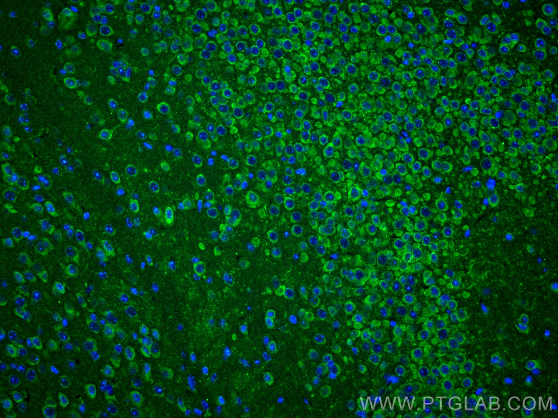 Immunofluorescence (IF) / fluorescent staining of mouse brain tissue using CHAT Polyclonal antibody (20747-1-AP)