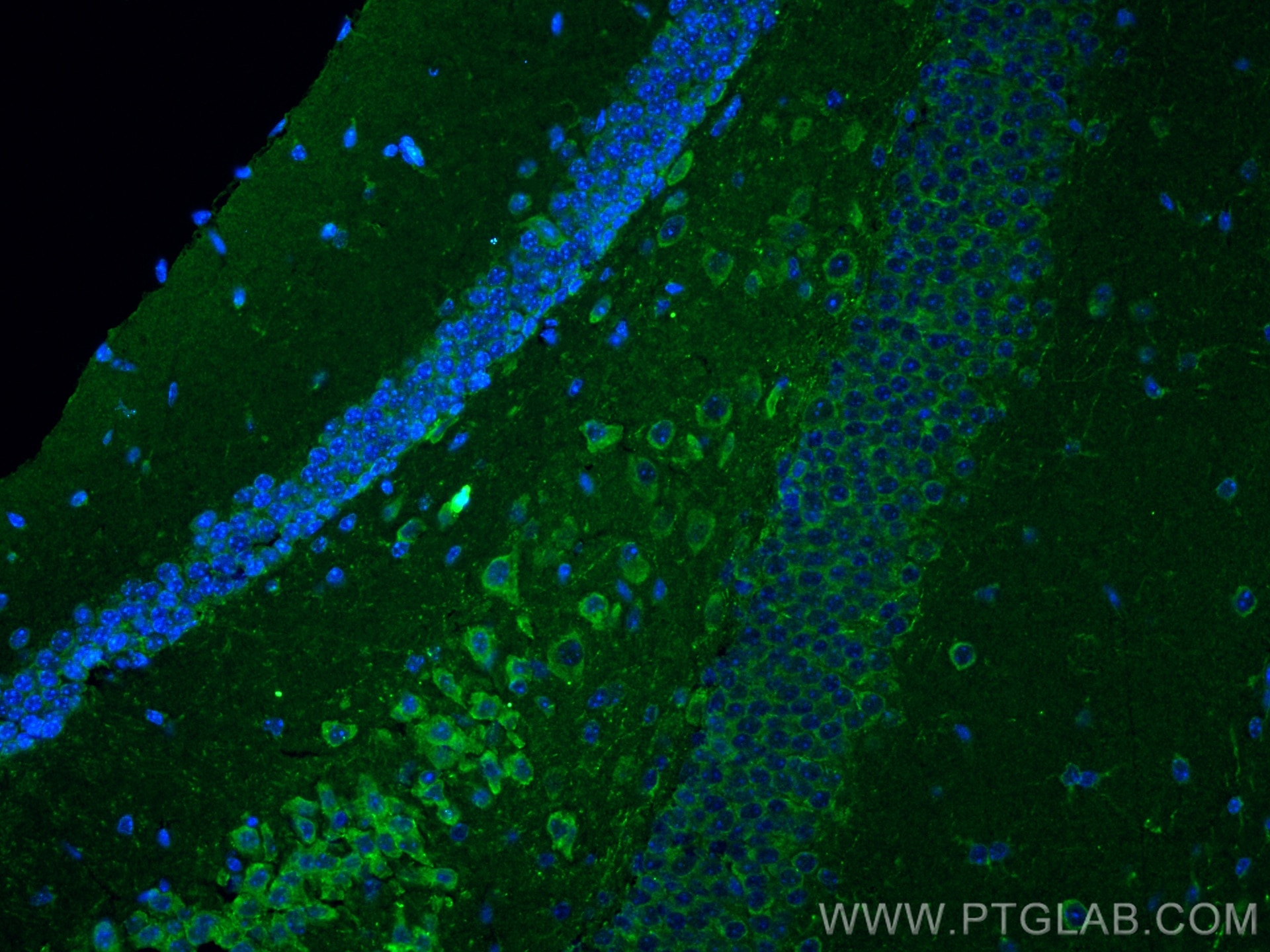 Immunofluorescence (IF) / fluorescent staining of mouse brain tissue using CHAT Polyclonal antibody (20747-1-AP)