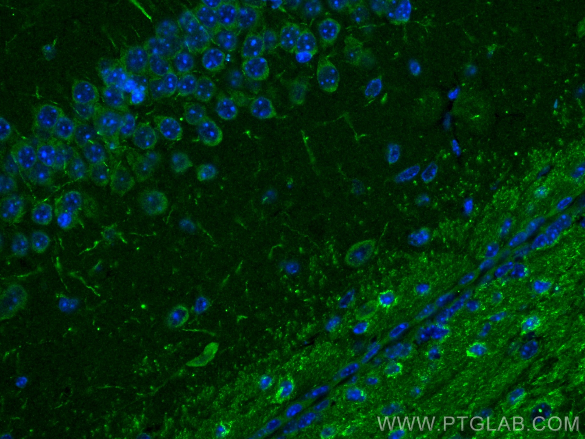 Immunofluorescence (IF) / fluorescent staining of mouse brain tissue using CHAT Polyclonal antibody (20747-1-AP)