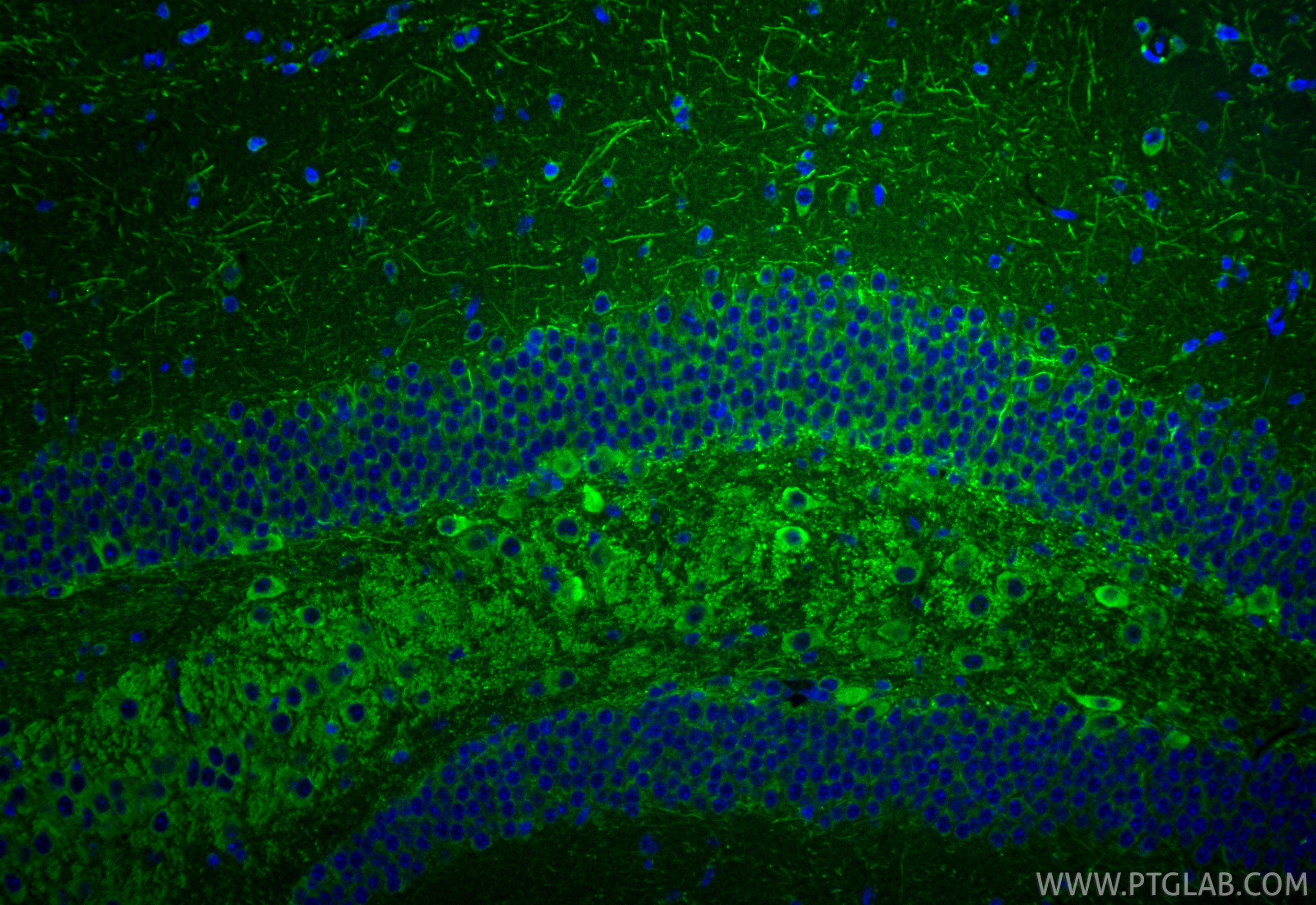 Immunofluorescence (IF) / fluorescent staining of mouse brain tissue using CHAT Polyclonal antibody (20747-1-AP)