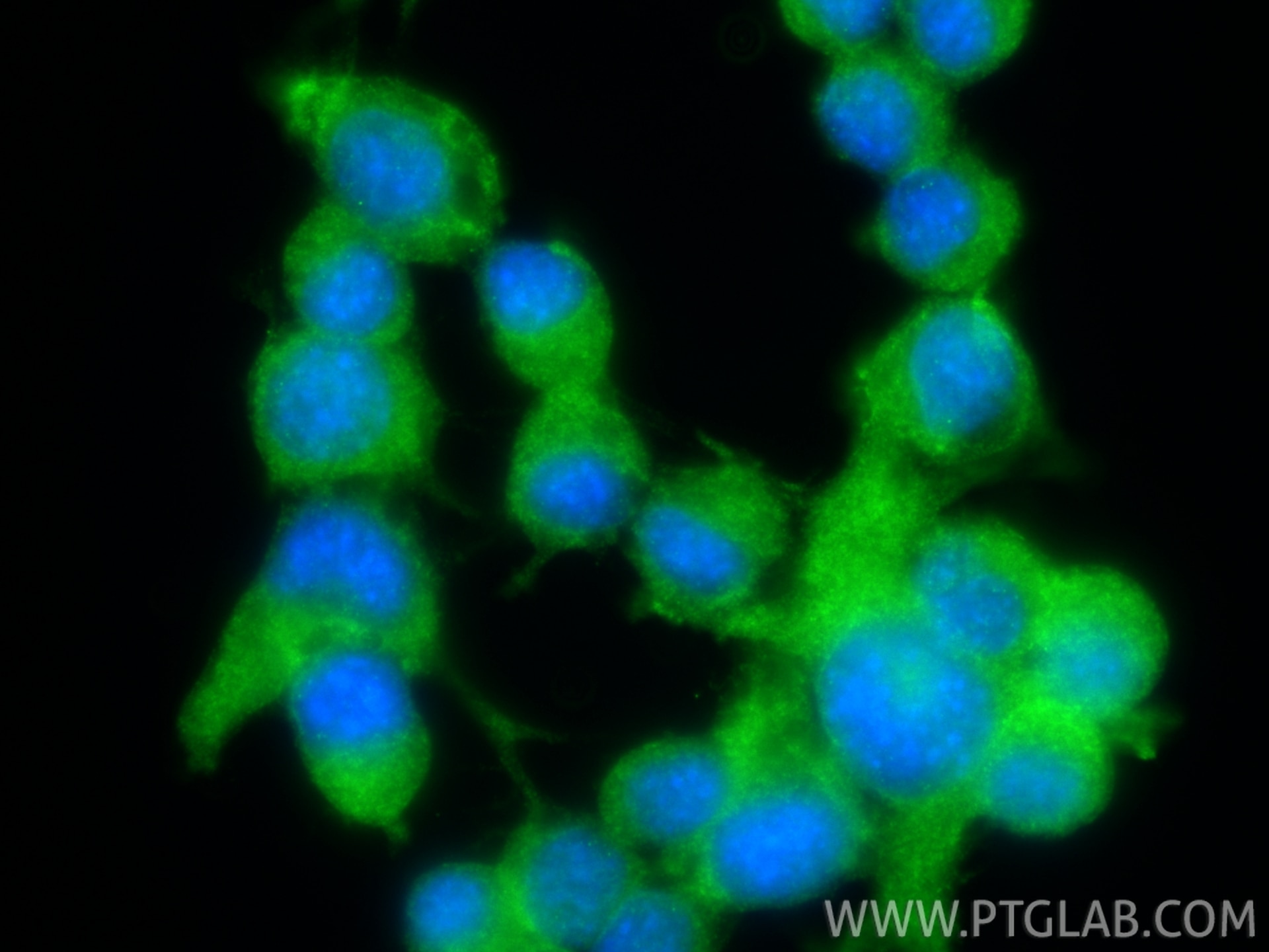 Immunofluorescence (IF) / fluorescent staining of Neuro-2a cells using CHAT Polyclonal antibody (20747-1-AP)