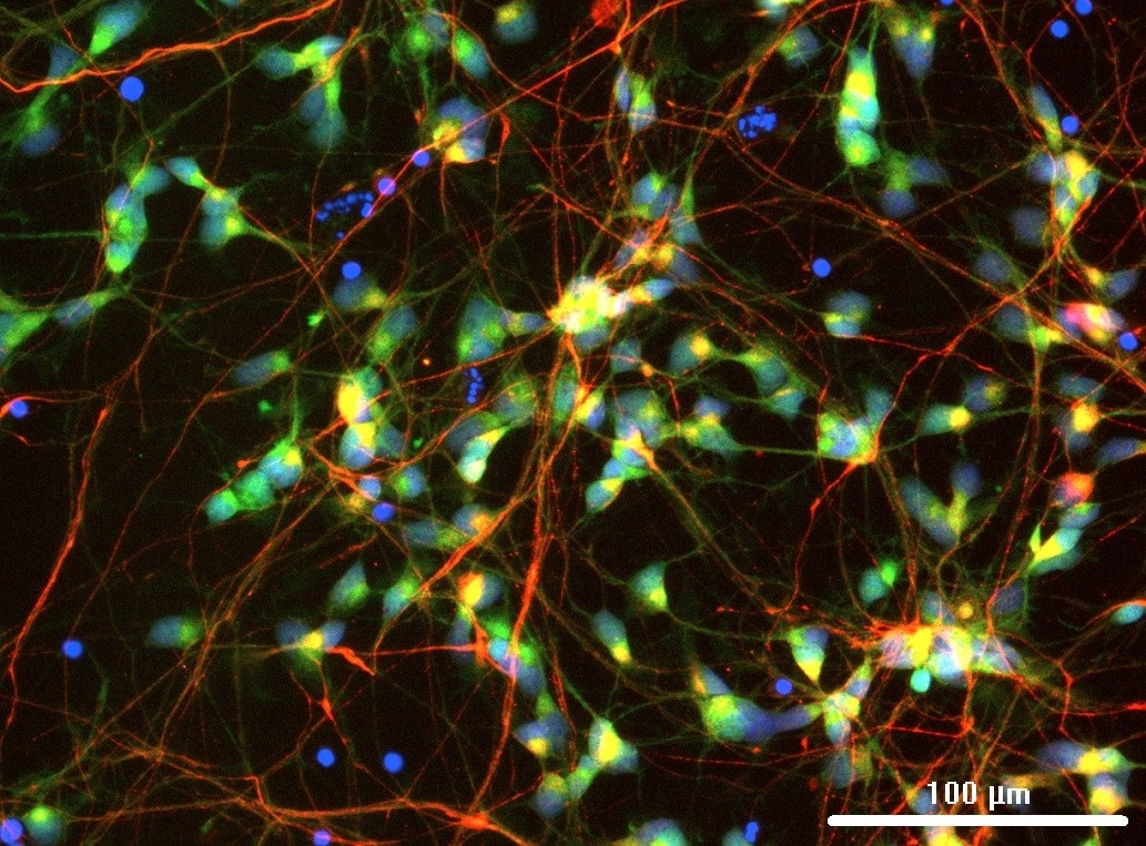 IF Staining of hiPSC-derived reporter spinal motor neurons using 20747-1-AP Immunofluorescence (IF) / fluorescent staining of hiPSC-derived reporter spinal motor neurons using CHAT Polyclonal antibody (20747-1-AP)