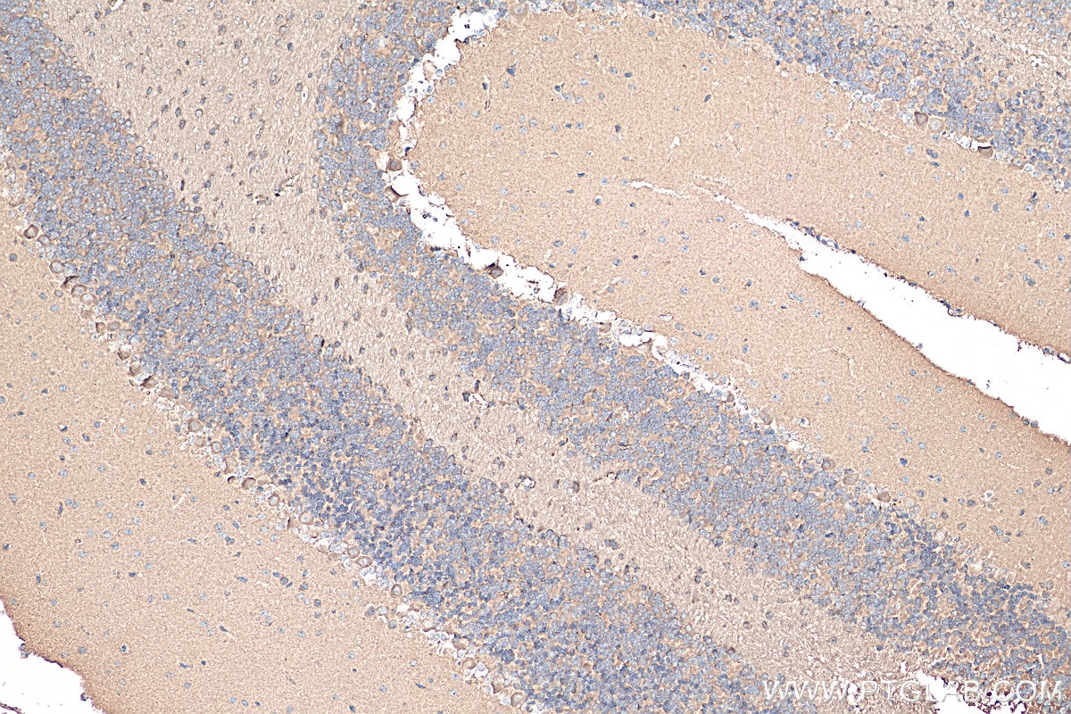 Immunohistochemistry (IHC) staining of mouse cerebellum tissue using CHAT Polyclonal antibody (20747-1-AP)