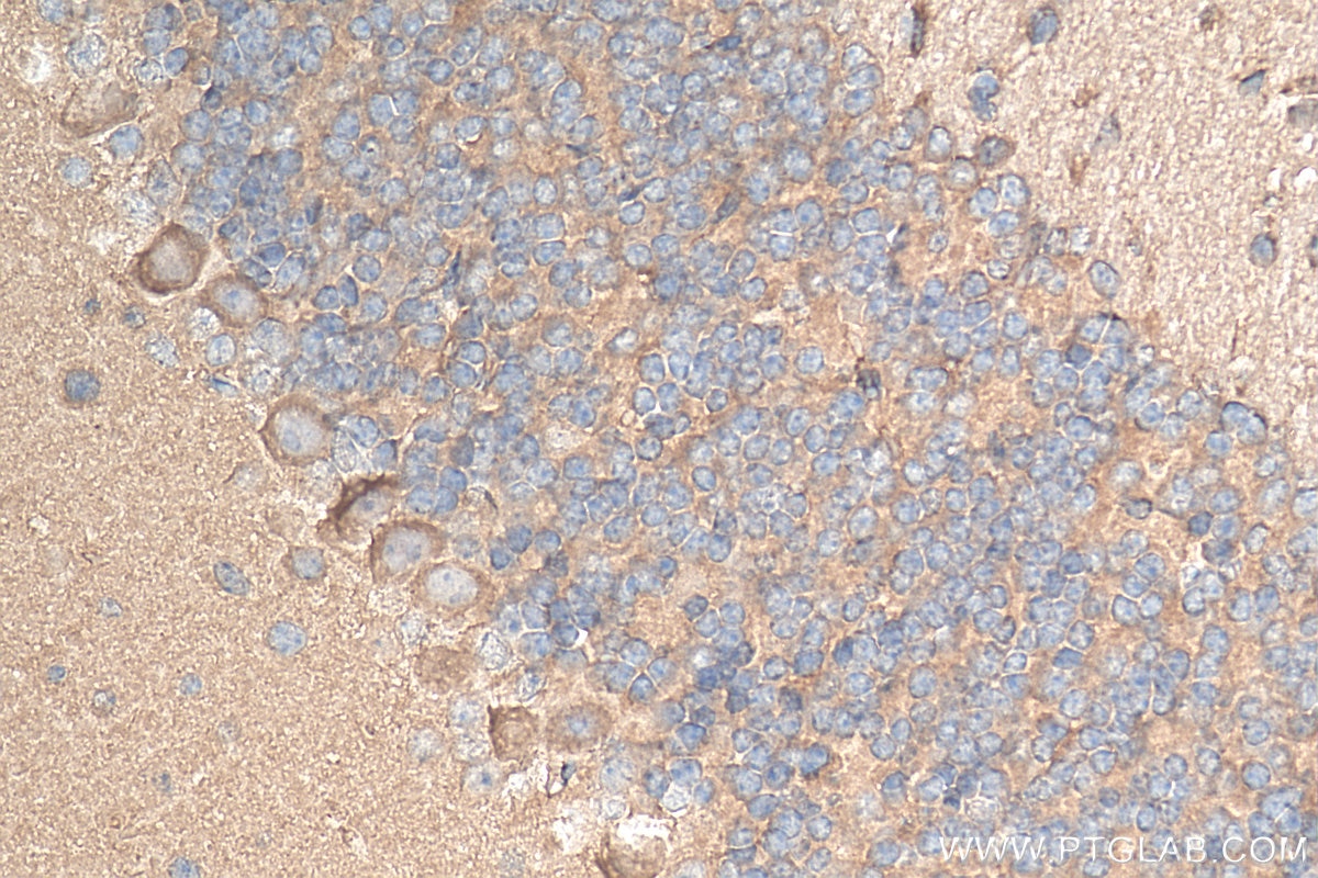 Immunohistochemistry (IHC) staining of mouse cerebellum tissue using CHAT Polyclonal antibody (20747-1-AP)
