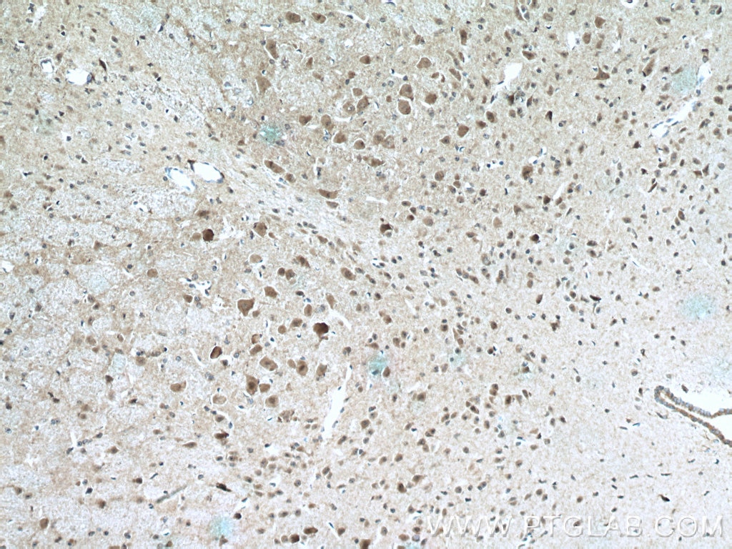 Immunohistochemistry (IHC) staining of mouse brain tissue using CHAT Polyclonal antibody (20747-1-AP)