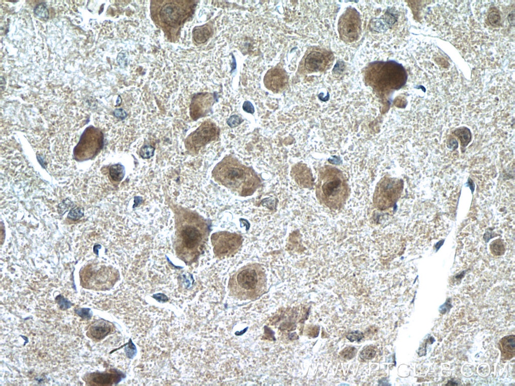 Immunohistochemistry (IHC) staining of mouse brain tissue using CHAT Polyclonal antibody (20747-1-AP)
