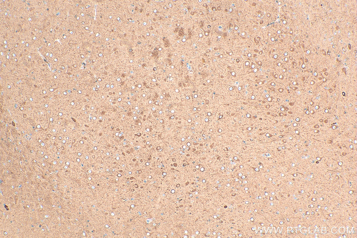 Immunohistochemistry (IHC) staining of rat brain tissue using CHAT Polyclonal antibody (20747-1-AP)