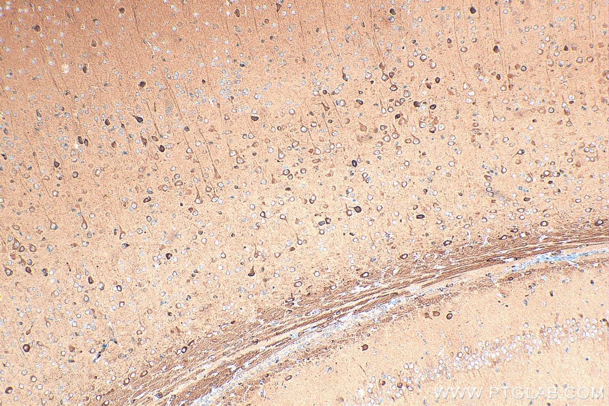 Immunohistochemistry (IHC) staining of mouse brain tissue using CHAT Polyclonal antibody (20747-1-AP)