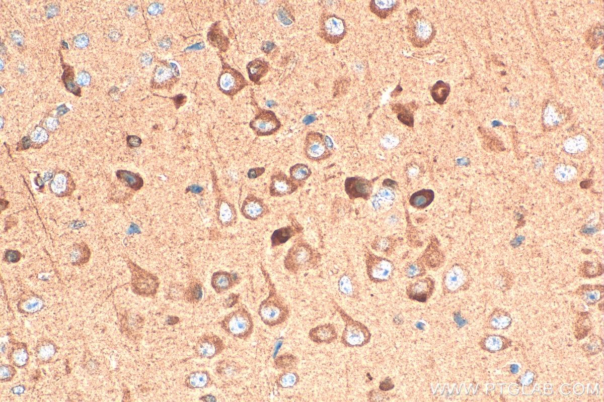 Immunohistochemistry (IHC) staining of mouse brain tissue using CHAT Polyclonal antibody (20747-1-AP)