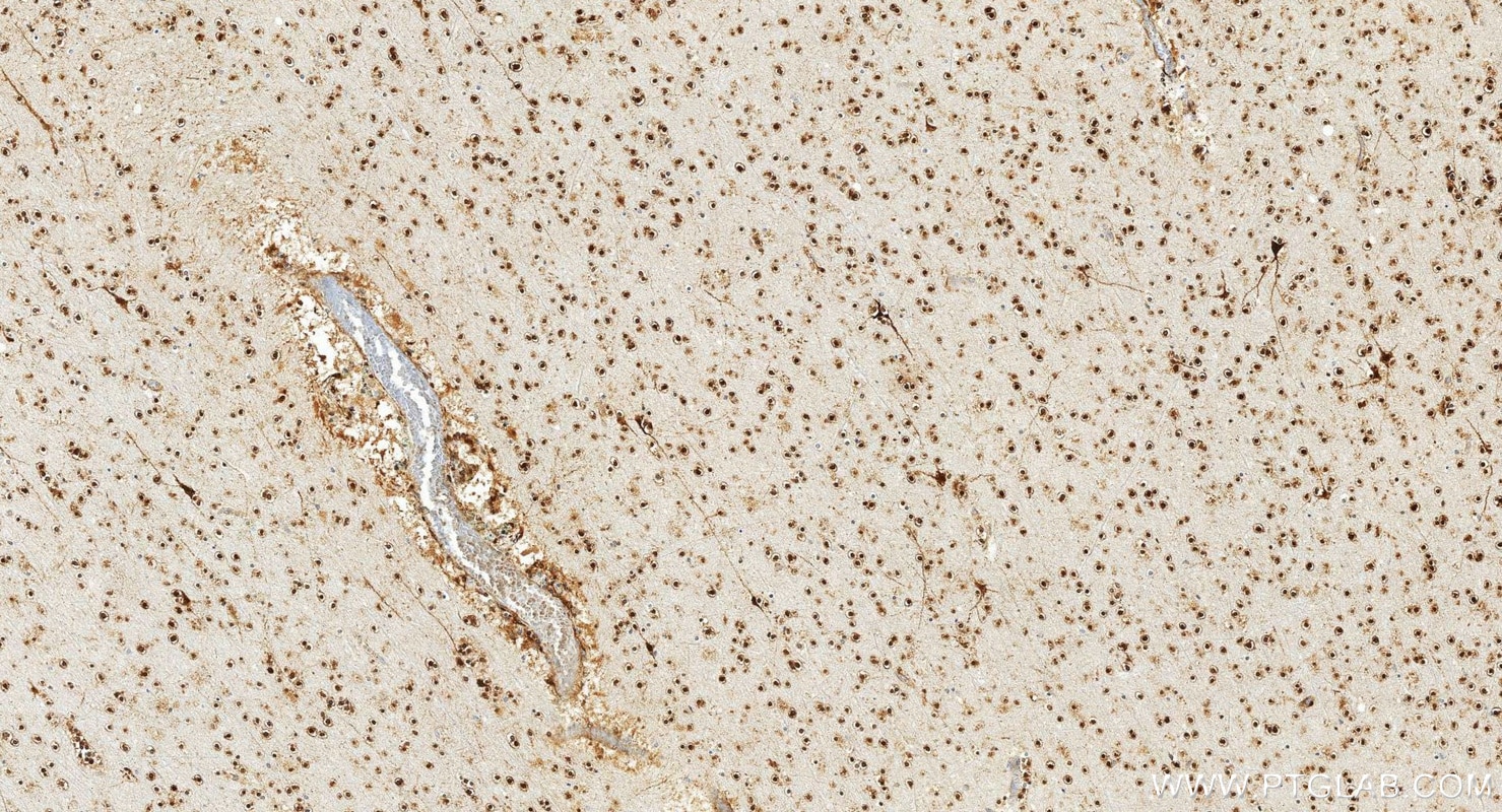 Immunohistochemistry (IHC) staining of human brain tissue using CHAT Polyclonal antibody (20747-1-AP)