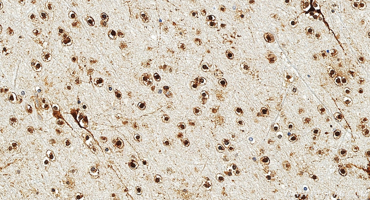 IHC staining of human brain using 20747-1-AP Immunohistochemistry (IHC) staining of human brain tissue using CHAT Polyclonal antibody (20747-1-AP)