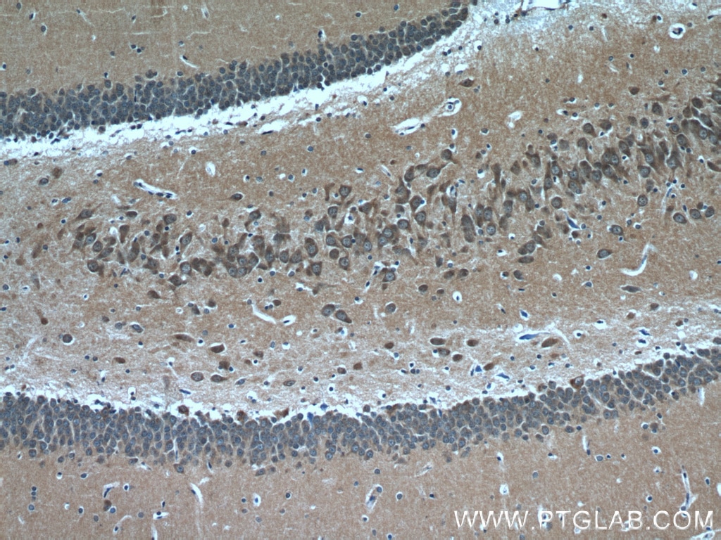 Immunohistochemistry (IHC) staining of rat brain tissue using CHAT Polyclonal antibody (20747-1-AP)